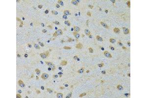 Immunohistochemistry of paraffin-embedded Rat brain using DARS Polyclonal Antibody at dilution of 1:100 (40x lens). (DARS Antikörper)