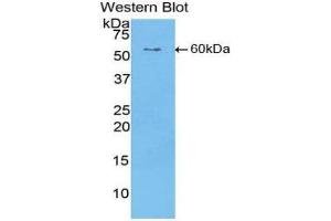 Western Blotting (WB) image for anti-Cartilage Intermediate Layer Protein, Nucleotide Pyrophosphohydrolase (CILP) (AA 603-846) antibody (ABIN1858408) (CILP Antikörper  (AA 603-846))