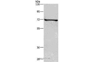 Western blot analysis of HT-29 cell, using TRIM29 Polyclonal Antibody at dilution of 1:400 (TRIM29 Antikörper)