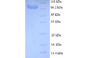 SDS-PAGE (SDS) image for Breast Carcinoma Amplified Sequence 1 (BCAS1) (AA 1-584), (full length) protein (GST tag) (ABIN4975868)