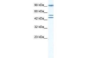 WB Suggested Anti-BRD2 Antibody Titration:  0. (BRD2 Antikörper  (Middle Region))