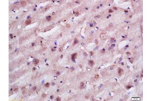 Formalin-fixed and paraffin embedded rat brain labeled with Anti-TACO1 Polyclonal Antibody, Unconjugated  at 1:200 followed by conjugation to the secondary antibody and DAB staining. (TACO1 Antikörper  (AA 51-150))