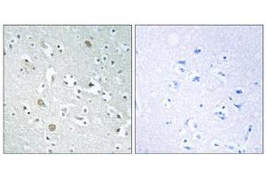 Immunohistochemistry analysis of paraffin-embedded human brain tissue using PLA1A antibody. (PLA1A Antikörper  (C-Term))
