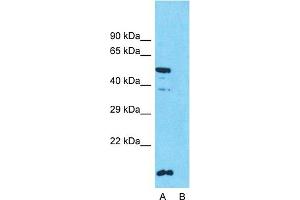 Host:  Rabbit  Target Name:  SLC10A1  Sample Type:  HT1080  Lane A:  Primary Antibody  Lane B:  Primary Antibody + Blocking Peptide  Primary Antibody Concentration:  1ug/ml  Peptide Concentration:  5ug/ml  Lysate Quantity:  25ug/lane/lane  Gel Concentration:  0.
