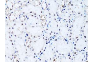 Immunohistochemistry of paraffin-embedded rat kidney using Histone H2B antibody (ABIN3015764, ABIN3015765, ABIN3015766 and ABIN6219109) at dilution of 1:100 (40x lens).