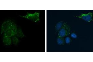 ICC/IF Image CD81 antibody detects CD81 protein at cell membrane and cytoplasm by immunofluorescent analysis.