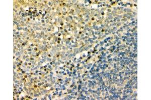 IHC analysis of GM130 using anti-GM130 antibody (ABIN6719432). (Golgin A2 (GOLGA2) (AA 796-913) Antikörper)