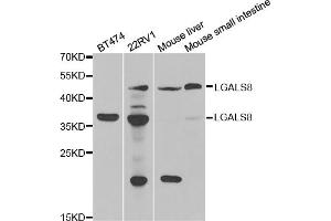 Western blot analysis of extracts of various cell lines, using LGALS8 antibody. (LGALS8 Antikörper)