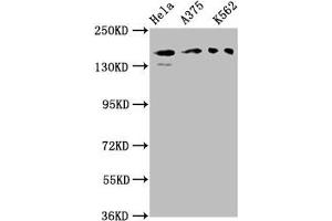 Western Blot Positive WB detected in: Hela whole cell lysate, A375 whole cell lysate, K562 whole cell lysate All lanes: PARD3 antibody at 3 μg/mL Secondary Goat polyclonal to rabbit IgG at 1/50000 dilution Predicted band size: 152, 142, 147, 139, 114, 109, 110, 150 kDa Observed band size: 152 kDa (PARD3 Antikörper  (AA 1068-1356))
