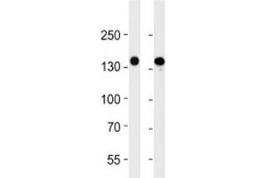 Western Blotting (WB) image for anti-Fms-Related Tyrosine Kinase 4 (FLT4) antibody (ABIN3030977)