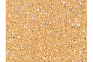 ABIN7094749 and ABIN7098800 at 1/100 staining Rat brain tissue by IHC-P. (BASP1 Antikörper  (N-Term))