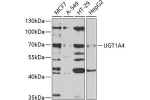 Western blot analysis of extracts of various cell lines, using UGT1 antibody (ABIN6132770, ABIN6149897, ABIN6149898 and ABIN6221194) at 1:1000 dilution.