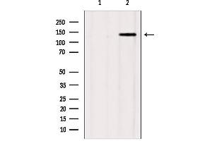 Western blot analysis of extracts from mouse brain, using GAK Antibody. (GAK Antikörper  (N-Term))