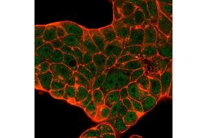 Immunofluorescence (IF) image for anti-CUGBP, Elav-Like Family Member 2 (CELF2) antibody (ABIN7504156)