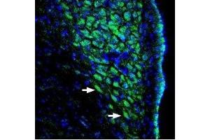 Immunohistochemistry (IHC) image for anti-Amiloride-Sensitive Cation Channel 2, Neuronal (ACCN2) (AA 368-382), (Extracellular) antibody (ABIN7042913)