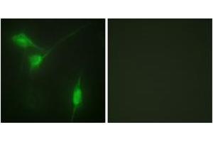 Immunofluorescence analysis of NIH-3T3 cells, using Akt (Phospho-Ser246) Antibody. (AKT1 Antikörper  (pSer246))