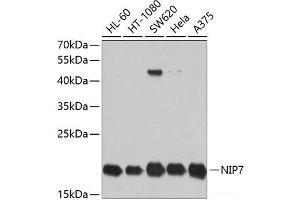 Western blot analysis of extracts of various cell lines using NIP7 Polyclonal Antibody at dilution of 1:1000. (NIP7 Antikörper)