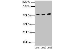 Western blot All lanes: CDR2 antibody at 4 μg/mL Lane 1: Mouse lung tissue Lane 2: Hela whole cell lysate Lane 3: HepG2 whole cell lysate Secondary Goat polyclonal to rabbit IgG at 1/10000 dilution Predicted band size: 52 kDa Observed band size: 52 kDa (CDR2 Antikörper  (AA 1-454))