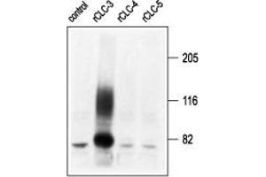 Western blot analysis of membranes from Xenopus oocytes, expressing CLC-3, CLC-4, and CLC-5, using Anti-CLC-3 (CLCN3) Antibody (ABIN7043052, ABIN7044121 and ABIN7044122) (kindly provided by Prof. (CLCN3 Antikörper  (C-Term, Intracellular))