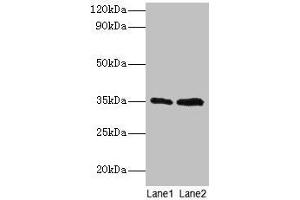 Western blot All lanes: GTF2B antibody at 2 μg/mL Lane 1: HepG2 whole cell lysate Lane 2: Hela whole cell lysate Secondary Goat polyclonal to rabbit IgG at 1/15000 dilution Predicted band size: 35 kDa Observed band size: 35 kDa