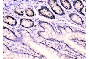 IHC analysis of HnRNPF using anti-HnRNPF antibody (ABIN4886622). (HNRNPF Antikörper  (N-Term))