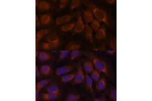 Immunofluorescence analysis of U-2 OS cells using CREB3 antibody (ABIN6128862, ABIN6139013, ABIN6139015 and ABIN6222241) at dilution of 1:100. (CREB3 Antikörper  (AA 1-230))