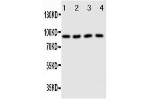 Anti-Cullin3 antibody, Western blotting Lane 1: HELA Cell Lysate Lane 2: MCF-7 Cell Lysate Lane 3: Rat Testis Tissue Lysate Lane 4: Rat Brain Tissue Lysate (Cullin 3 Antikörper  (Middle Region))