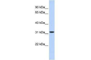 WB Suggested Anti-HIBADH Antibody Titration: 0. (HIBADH Antikörper  (Middle Region))