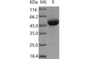 Western Blotting (WB) image for CD79b Molecule, Immunoglobulin-Associated beta (CD79B) protein (Fc Tag) (ABIN7321126)