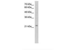 Image no. 2 for anti-Epithelial Membrane Protein 2 (EMP2) (C-Term) antibody (ABIN203481) (EMP2 Antikörper  (C-Term))