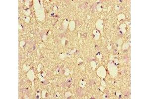 Immunohistochemistry of paraffin-embedded human brain tissue using ABIN7161278 at dilution of 1:100 (NEFL Antikörper  (AA 128-271))