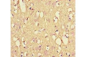 Immunohistochemistry of paraffin-embedded human brain tissue using ABIN7161278 at dilution of 1:100 (NEFL Antikörper  (AA 128-271))