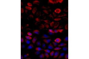 Immunofluorescence analysis of HeLa cells using FGFR2 antibody (ABIN6130457, ABIN6140615, ABIN6140617 and ABIN6216059) at dilution of 1:100 (40x lens). (FGFR2 Antikörper  (AA 245-345))