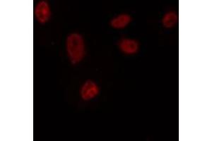 ABIN6272423 staining HepG2 by IF/ICC. (Retinoid X Receptor gamma Antikörper  (Internal Region))