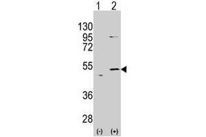 Western blot analysis of ALDH5A1 (arrow) using rabbit ALDH5A1 polyclonal antibody . (ALDH5A1 Antikörper  (N-Term))