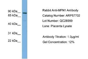 WB Suggested Anti-MFN1  Antibody Titration: 0.