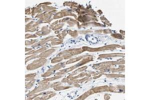 Immunohistochemical staining of human heart muscle with HHATL polyclonal antibody  shows moderate cytoplasmic positivity in myocytes at 1:10-1:20 dilution. (HHATL Antikörper)