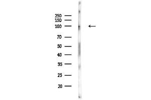 Western blot analysis of lysates from PC12 cells(UV,30 min treatment), using DNA Ligase IV Antibody at 1/1000 dilution.