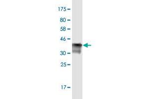 Western Blotting (WB) image for anti-Hepatitis B Virus X-Interacting Protein (HBXIP) (AA 83-173) antibody (ABIN523960)