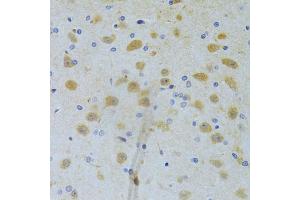 Immunohistochemistry of paraffin-embedded rat brain using CHIA Antibody (ABIN5973937) at dilution of 1/100 (40x lens). (CHIA Antikörper)