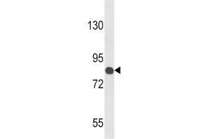 Western Blotting (WB) image for anti-Cartilage Oligomeric Matrix Protein (COMP) antibody (ABIN3002869) (COMP Antikörper)