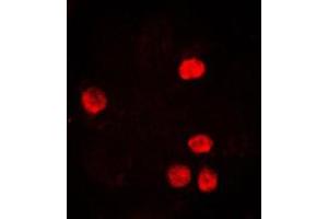Immunofluorescent analysis of PCNA staining in HeLa cells. (PCNA Antikörper  (Center))