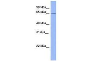 Image no. 1 for anti-Methyltransferase Like 3 (METTL3) (AA 503-552) antibody (ABIN6741673) (METTL3 Antikörper  (AA 503-552))