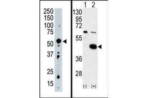 (LEFT) Western blot analysis of PDK2 Antibody (C-term) in mouse intestine tissue lysate (35ug/lane). (PDK2 Antikörper  (C-Term))