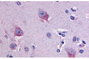 Anti-LPHN1 antibody  ABIN1049023 IHC staining of human brain, neurons and glia. (Latrophilin 1 Antikörper  (C-Term))