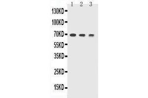 Anti-TREM1 antibody, Western blotting Lane 1: Recombinant Mouse TREM1 Protein 10ng Lane 2: Recombinant Mouse TREM1 Protein 5ng Lane 3: Recombinant Mouse TREM1 Protein 2. (TREM1 Antikörper  (AA 74-90))