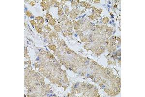 Immunohistochemistry of paraffin-embedded human stomach using BEST1 antibody. (Bestrophin 1 Antikörper  (AA 200-300))