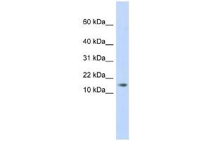 C11ORF67 antibody used at 1 ug/ml to detect target protein. (AAMDC Antikörper  (Middle Region))