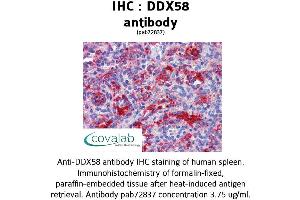 Image no. 3 for anti-DEAD (Asp-Glu-Ala-Asp) Box Polypeptide 58 (DDX58) antibody (ABIN1733572)