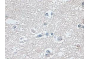 Immunohistochemistry (IHC) image for anti-Myosin Heavy Chain 7, Cardiac Muscle, beta (MYH7) (AA 26-309) antibody (ABIN7440755)